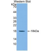 Western blot analysis of recombinant Mouse IL1F9.