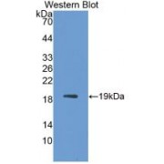 Western blot analysis of recombinant Simian IL1RA.