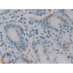 Epstein Barr Virus Induced Protein 3 (EBI3) Antibody