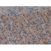 IHC-P analysis of Stomach Tissue, with DAB staining.