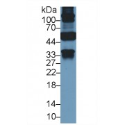 Western blot analysis of Human Liver lysate, using Human KRT18 Antibody (2 µg/ml) and HRP-conjugated Goat Anti-Mouse antibody (<a href="https://www.abbexa.com/index.php?route=product/search&amp;search=abx400001" target="_blank">abx400001</a>, 0.2 µg/ml).