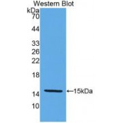 Western blot analysis of recombinant Human KLb.