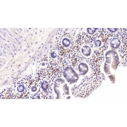 Interleukin-6 (IL6) Antibody