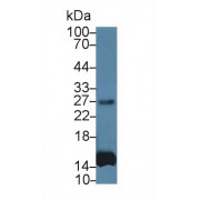 Western blot analysis of Human Leukocyte lysate, using Simian IL6 Antibody and HRP-conjugated Goat Anti-Mouse antibody (<a href="https://www.abbexa.com/index.php?route=product/search&amp;search=abx400001" target="_blank">abx400001</a>, 0.2 µg/ml).