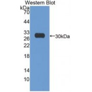 Western blot analysis of recombinant Human Ki67P.