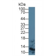 Western blot analysis of Human Lymphocyte lysate, using Human S100A8 Antibody (5 µg/ml) and HRP-conjugated Goat Anti-Mouse antibody (<a href="https://www.abbexa.com/index.php?route=product/search&amp;search=abx400001" target="_blank">abx400001</a>, 0.2 µg/ml).