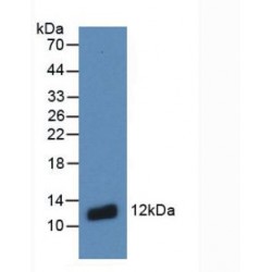Protein S100-A8 / CAGA (S100A8) Antibody