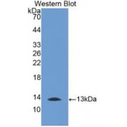 Western blot analysis of recombinant Human MTNR1A.