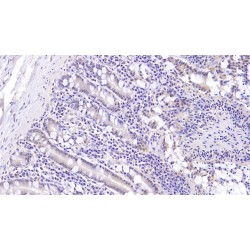 Mucin-5B (MUC5B) Antibody