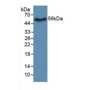 Western blot analysis of recombinant Rat Nicotinamide Phosphoribosyltransferase / Visfatin.