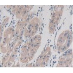 Transmembrane Protein 27 (TMEM27) Antibody