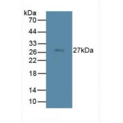 Western blot analysis of Rat Spleen Tissue using Transmembrane Protein 27 Antibody (3 µg/ml), followed by HRP-conjugated Goat Anti-Mouse antibody (<a href="https://www.abbexa.com/index.php?route=product/search&amp;search=abx400001" target="_blank">abx400001</a>, 0.2 µg/ml).