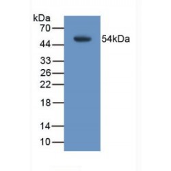 Transmembrane Protein 27 (TMEM27) Antibody