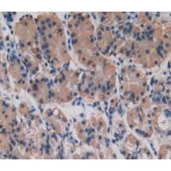 Procollagen Type I N-Terminal Propeptide (PINP) Antibody