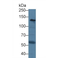 Procollagen Type I N-Terminal Propeptide (PINP) Antibody