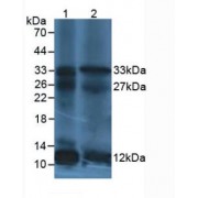 Western blot analysis of (1) Human leukocyte Cells and (2) Human Lymphocytes Cells.