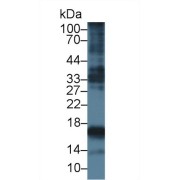 Western blot analysis of Rat Uterus lysate, using Human PIIINP Antibody (5 µg/ml) and HRP-conjugated Goat Anti-Mouse antibody (<a href="https://www.abbexa.com/index.php?route=product/search&amp;search=abx400001" target="_blank">abx400001</a>, 0.2 µg/ml).
