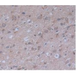 Procollagen Type III N-Terminal Propeptide (PIIINP) Antibody