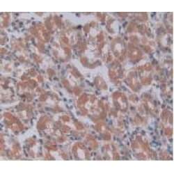 Procollagen Type III N-Terminal Propeptide (PIIINP) Antibody