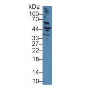Western blot analysis of Human HeLa cell lysate, using Human KRT17 Antibody (2 µg/ml) and HRP-conjugated Goat Anti-Mouse antibody (<a href="https://www.abbexa.com/index.php?route=product/search&amp;search=abx400001" target="_blank">abx400001</a>, 0.2 µg/ml).