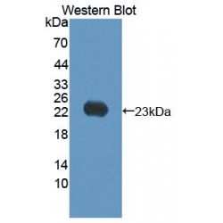 Keratin 17 (KRT17) Antibody