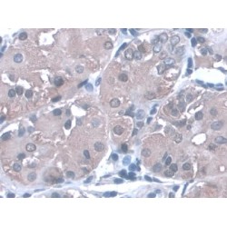 Pepsinogen A (PGA) Antibody
