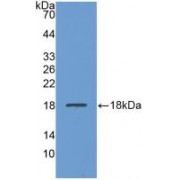 Western blot analysis of recombinant Human LCAT.