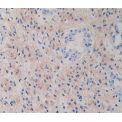 Isocitrate Dehydrogenase 1, Soluble (IDH1) Antibody