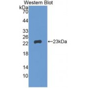 Western blot analysis of recombinant Human GREM1.