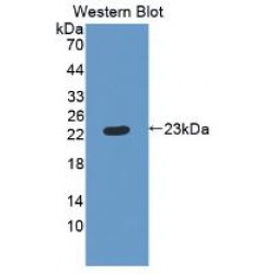 Retinol Binding Protein 4, Plasma (RBP4) Antibody