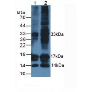 Western blot analysis of (1) Rat Thyroid Tissue and (2) Human SW579 Cells.