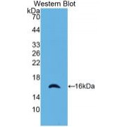 Western blot analysis of recombinant Human CRADD.