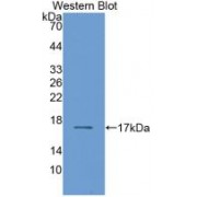 Western blot analysis of recombinant Human RBP2.