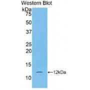 Western blot analysis of recombinant Human S100A5.