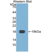 Western blot analysis of recombinant Human S100A3 Protein.