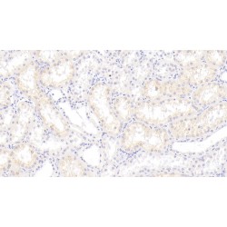 S100 Calcium Binding Protein A3 (S100A3) Antibody