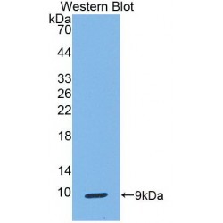 Uteroglobin (SCGB1A1) Antibody