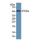 Western blot analysis of recombinant Human PAI1.