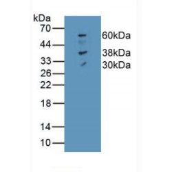 Ferroportin / FPN (SLC40A1) Antibody