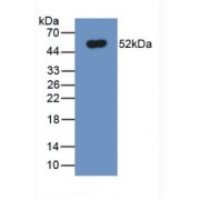 Western blot analysis of recombinant Human FPN.