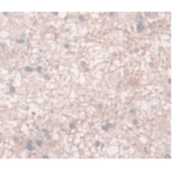 Ferroportin / FPN (SLC40A1) Antibody