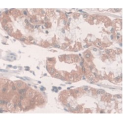 Ferroportin / FPN (SLC40A1) Antibody