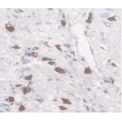 Ferroportin / FPN (SLC40A1) Antibody