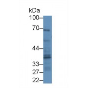 Western blot analysis of Rat Placenta lysate, using Human FPN Antibody (2 µg/ml) and HRP-conjugated Goat Anti-Mouse antibody (<a href="https://www.abbexa.com/index.php?route=product/search&amp;search=abx400001" target="_blank">abx400001</a>, 0.2 µg/ml).