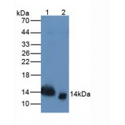 Western blot analysis of (1) Rat Serum Tissue, and (2) Rat Spleen Tissue, using Rabbit Anti-Rat TFF2 Antibody (3 µg/ml) and HRP-conjugated Rabbit Anti-Mouse antibody (<a href="https://www.abbexa.com/index.php?route=product/search&amp;search=abx400002" target="_blank">abx400002</a>, 1:5000 dilution).