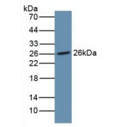 Western blot analysis of Rat Placenta Tissue, using Rabbit Anti-Rat TFF2 Antibody (3 µg/ml) and HRP-conjugated Rabbit Anti-Mouse antibody (<a href="https://www.abbexa.com/index.php?route=product/search&amp;search=abx400002" target="_blank">abx400002</a>, 1:5000 dilution).