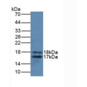 Western blot analysis of recombinant Rat IL2.