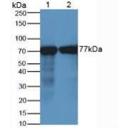 abx132083