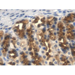 Tissue Factor Pathway Inhibitor (TFPI) Antibody