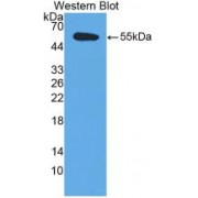 Western blot analysis of recombinant Human TFPI.